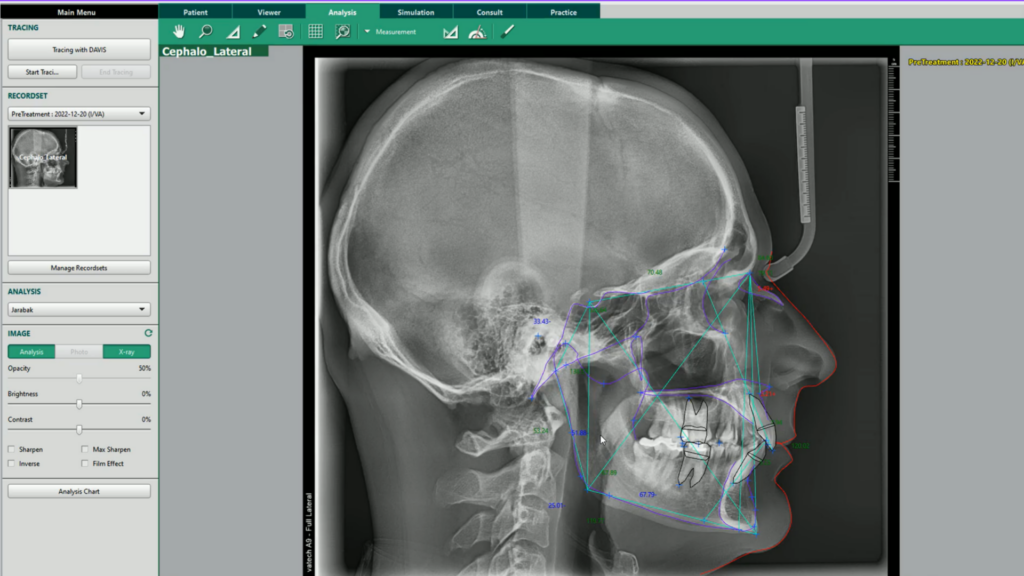 Vatech Web [Function EzOrtho preview]