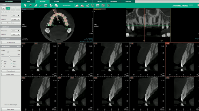 Vatech Clinical Cases