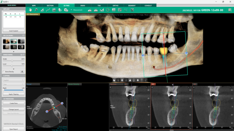 3D Panoramic Image